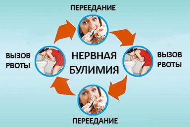 Лечение булимии в Вознесенском